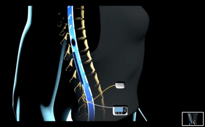 Screenshot 2018-11-25 at 14.03.16.png